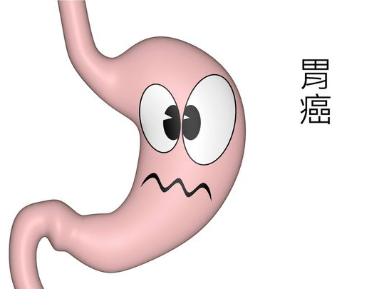 幽门螺杆菌治疗，维生素或大蒜补充剂可以降低胃癌的