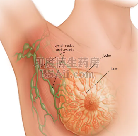 乳腺癌脑转移能活多久？药厂实拍