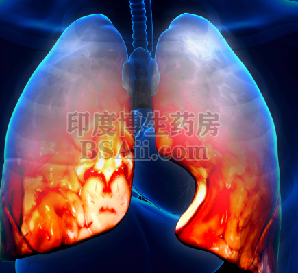 4款治疗ROS1阳性非小细