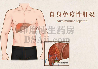 8种治疗自身免疫性肝
